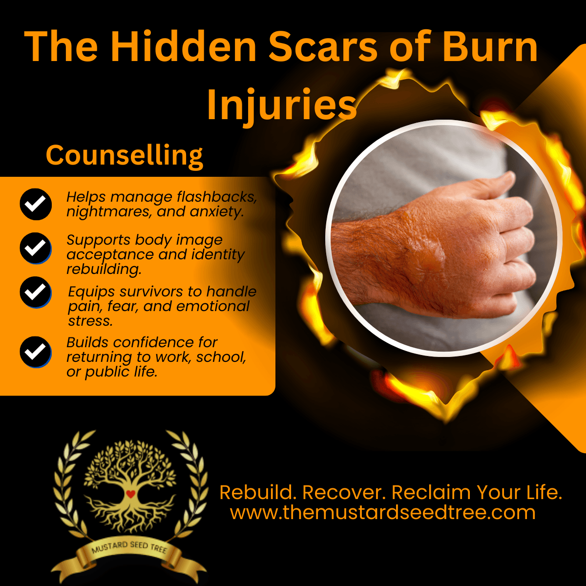 From the 5th to 9th of May, we observe National Burns Awareness Week –