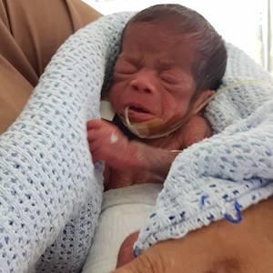 Tiny, vulnerable and premature.