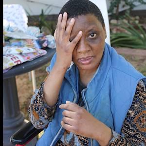 Help Cheshire Home Summerstrand by Sponsoring wheelchairs for much needed beneficiaries for Needy beneficiaries